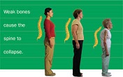 bone-density.jpg