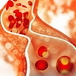cholesterol.jpg