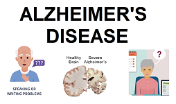 alzheimers2.png