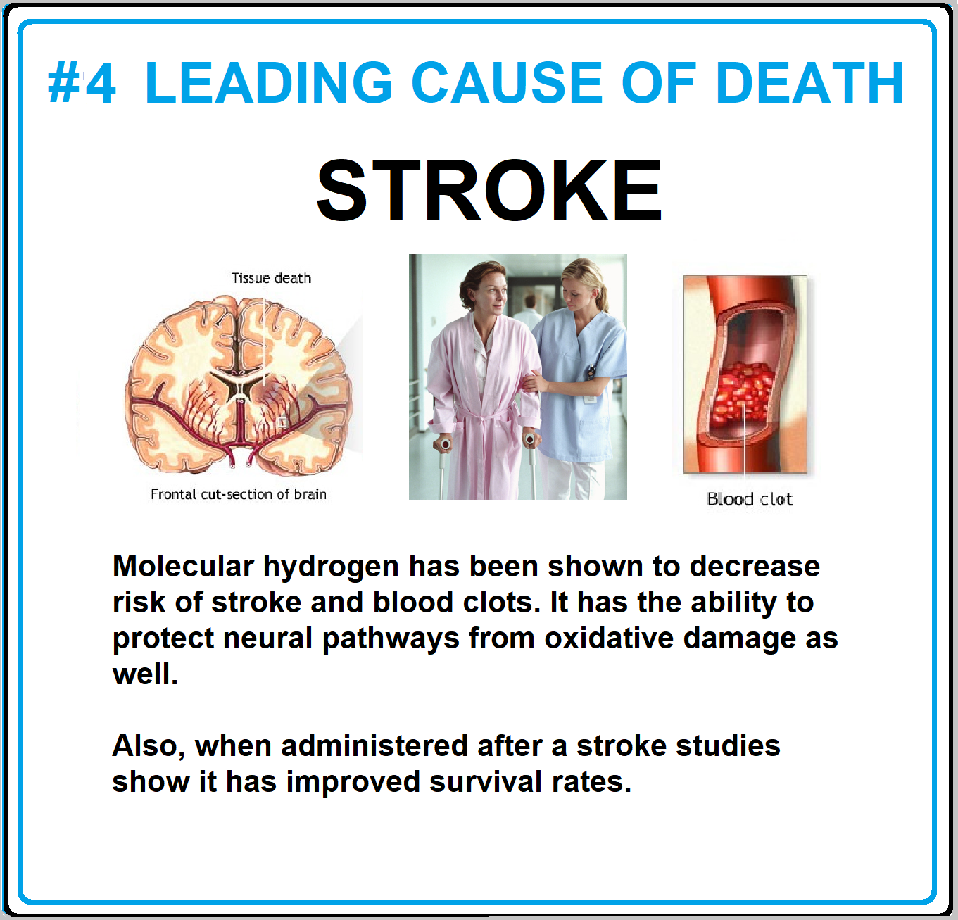 stroke.png